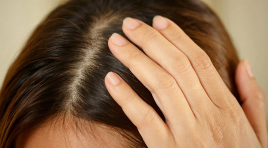How To Do A Scalp Detox + 7 Signs You Need It